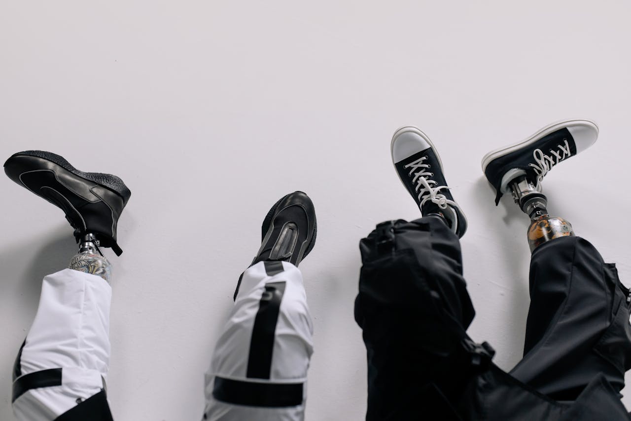 Close-up of two prosthetic legs wearing stylish sneakers against a white background.